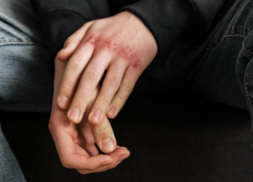 Homens vítimas de violência sexual enfrentam silêncio e estigma no Brasil 