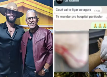 Irmão de Gusttavo Lima é mordido por macaco durante passeio no Parque Areião, em Goiânia 