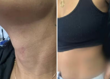 Mulher finge pedir pizza para denunciar agressões do ex-companheiro em Cidade Ocidental 