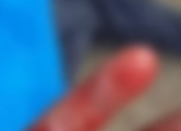 Homem é preso suspeito de decepar dedo do enteado após discussão com a ex