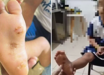 Mãe e padrasto são presos suspeitos de tortura contra criança de 4 anos em Mara Rosa