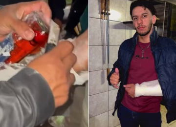 Homem tenta entrar em festa com uísque escondido em gesso no braço em Aparecida de Goiânia