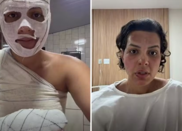 Nutricionista sofre queimaduras graves durante faxina em Goiânia