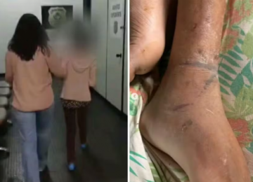 Homem acorrentado pela mãe em Goiás sofreu três AVCsv