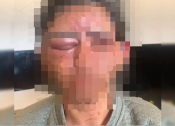 Mulher é estrangulada com toalha após invasão de casa em Cristalina