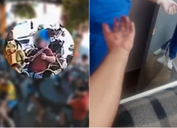 Torcedor tem mão dilacerada após rojão explodir durante jogo do Brasil em Goiás