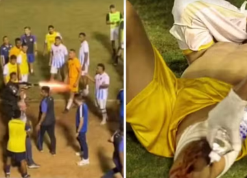 Goleiro baleado por PM em jogo será indenizado em R$ 97 mil