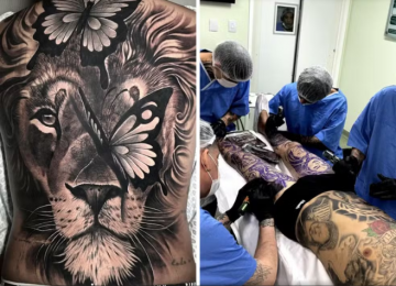 CFM proíbe uso de anestesia geral para tatuagens: entenda os riscos e exceções