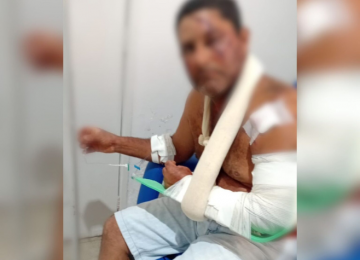 Vaqueiro é atacado por onça-pintada em Campinaçu e sobrevive após luta com facão