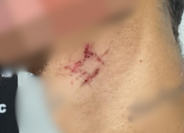 Homem é libertado após um ano mantido como escravo sexual por traficante em Goiânia