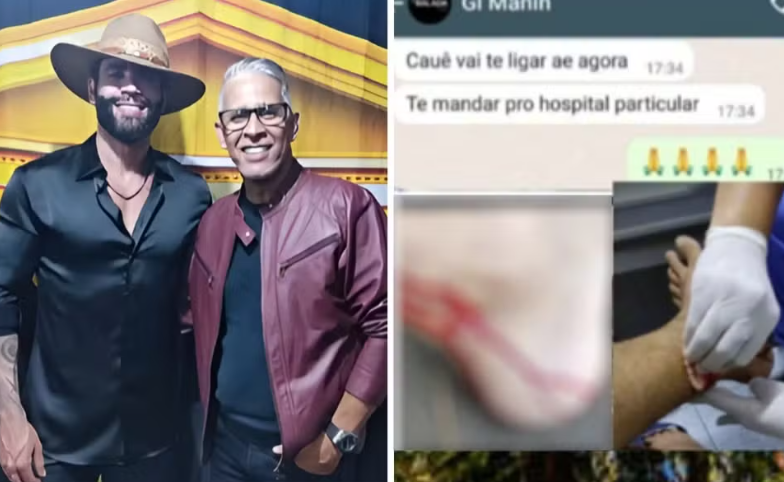 Irmão de Gusttavo Lima é mordido por macaco durante passeio no Parque Areião, em Goiânia 
