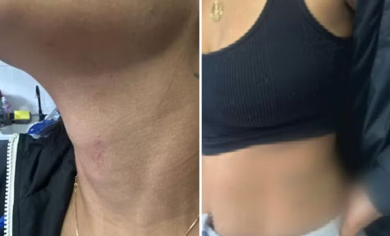 Mulher finge pedir pizza para denunciar agressões do ex-companheiro em Cidade Ocidental 