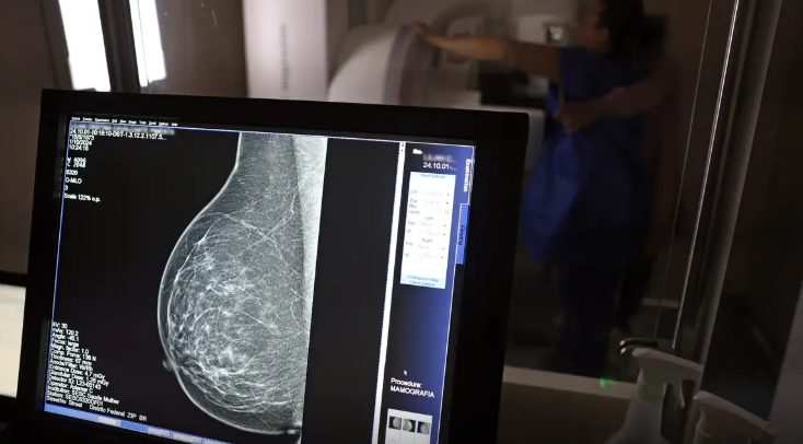Ministério da Saúde passa a recomendar mamografia a partir dos 40 anos
