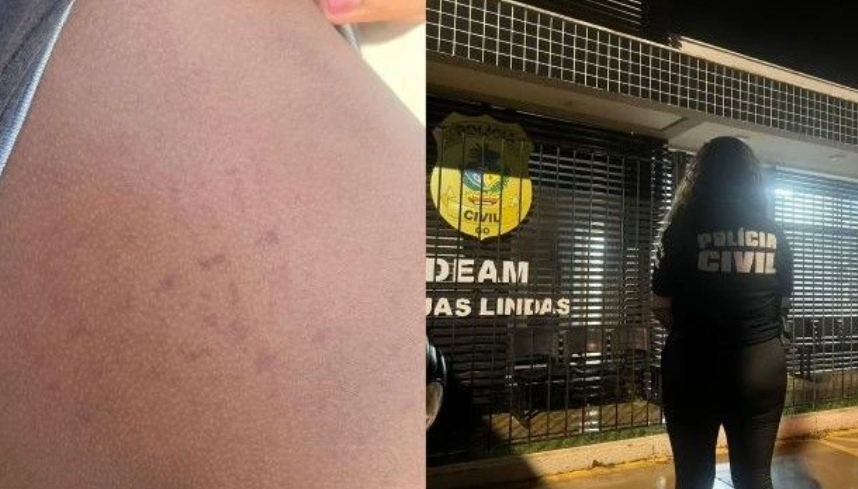 Mãe tortura filho de 14 anos e obriga irmã a se prostituir