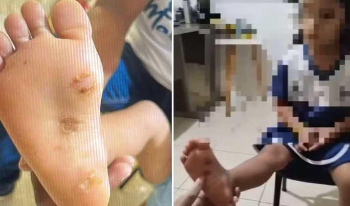 Mãe e padrasto são presos suspeitos de tortura contra criança de 4 anos em Mara Rosa