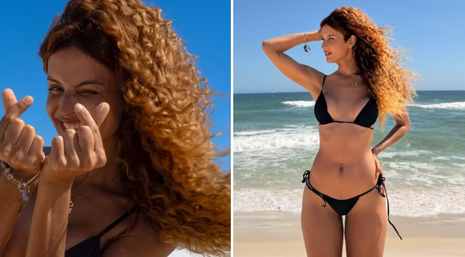 Atriz trans de Três Graças revela custo e detalhes da cirurgia de redesignação sexual