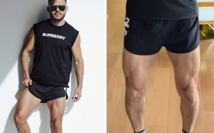 Academia é condenada após constranger aluno por roupa