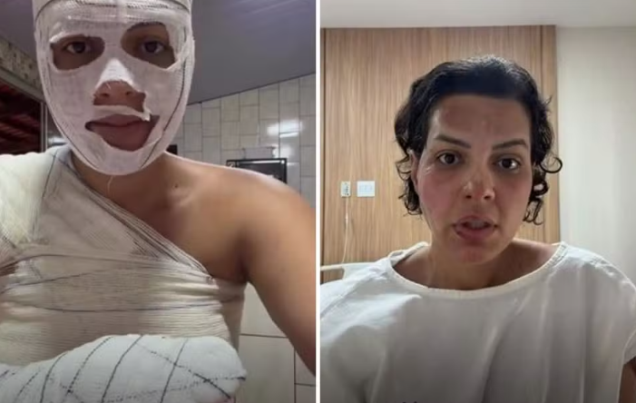 Nutricionista sofre queimaduras graves durante faxina em Goiânia