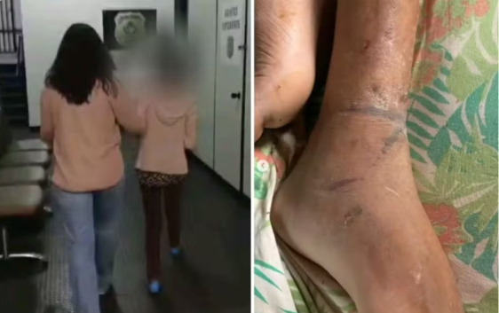 Homem acorrentado pela mãe em Goiás sofreu três AVCsv