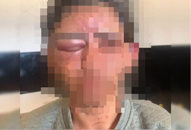 Mulher é estrangulada com toalha após invasão de casa em Cristalina