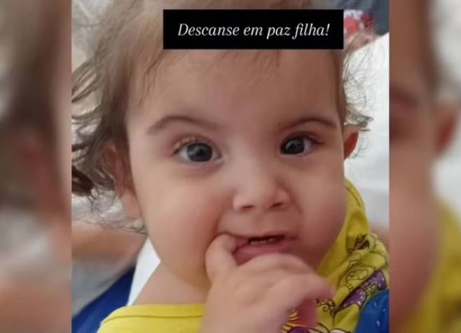 Morre uma das gêmeas siamesas separadas em cirurgia inédita em Goiânia