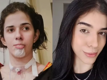 Mãe de jovem que ficou com sequelas após cheirar pimenta faz desabafo após três anos do caso