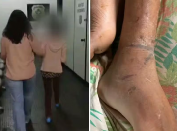 Homem acorrentado pela mãe em Goiás sofreu três AVCsv