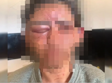 Mulher é estrangulada com toalha após invasão de casa em Cristalina