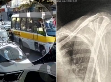 Mulher sofre 21 fraturas após ser prensada entre carro e ônibus escolar em Luziânia
