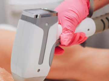 Mulher queimada em depilação a laser será indenizada