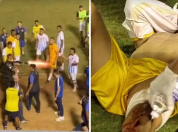 Goleiro baleado por PM em jogo será indenizado em R$ 97 mil