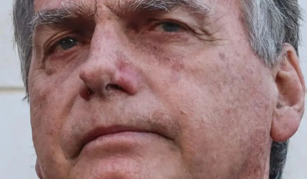 Bolsonaro deixa prisão para ser internado em hospital no DF na véspera de Natal