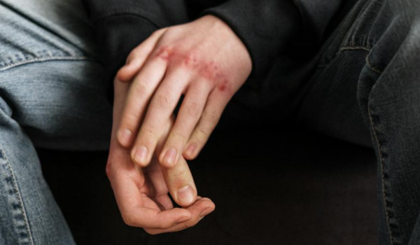 Homens vítimas de violência sexual enfrentam silêncio e estigma no Brasil 