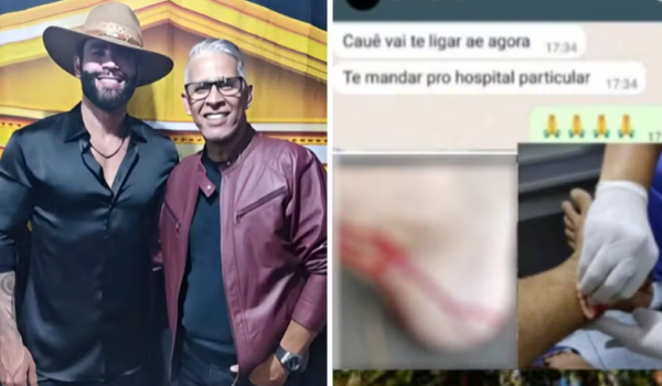 Irmão de Gusttavo Lima é mordido por macaco durante passeio no Parque Areião, em Goiânia 