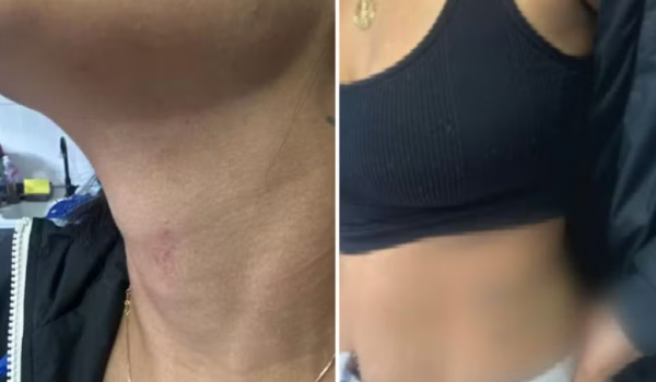 Mulher finge pedir pizza para denunciar agressões do ex-companheiro em Cidade Ocidental 