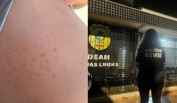 Mãe tortura filho de 14 anos e obriga irmã a se prostituir