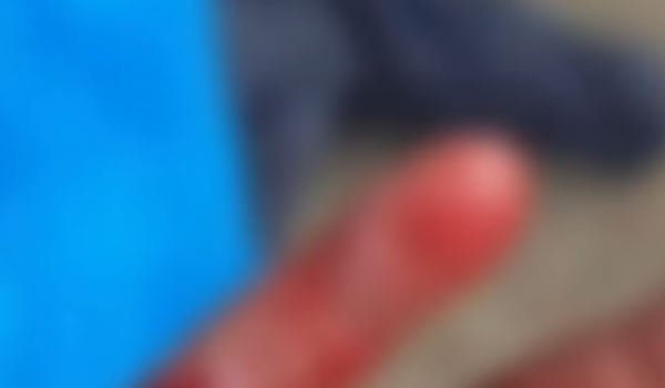 Homem é preso suspeito de decepar dedo do enteado após discussão com a ex