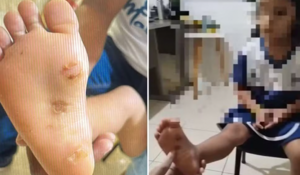 Mãe e padrasto são presos suspeitos de tortura contra criança de 4 anos em Mara Rosa