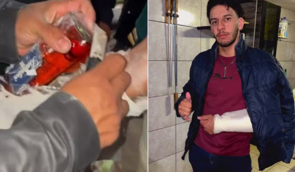 Homem tenta entrar em festa com uísque escondido em gesso no braço em Aparecida de Goiânia