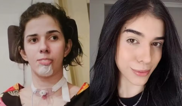 Mãe de jovem que ficou com sequelas após cheirar pimenta faz desabafo após três anos do caso