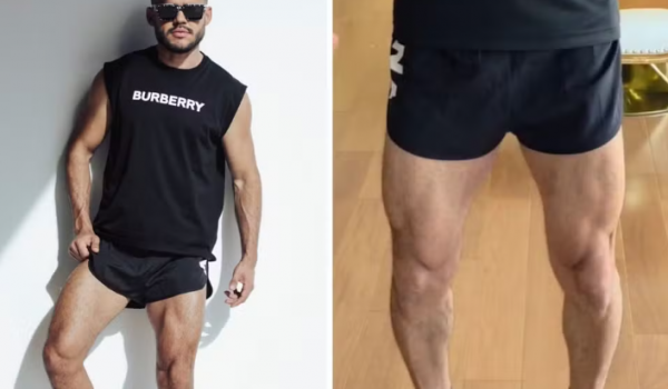 Academia é condenada após constranger aluno por roupa