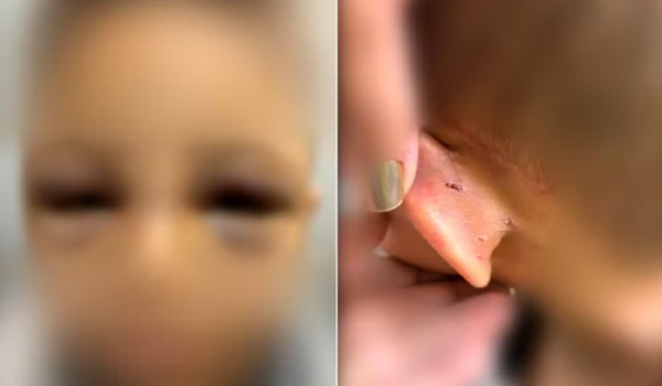 Pai é preso suspeito de espancar filho de 6 anos em Goiânia