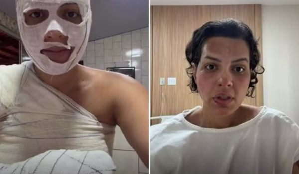 Nutricionista sofre queimaduras graves durante faxina em Goiânia