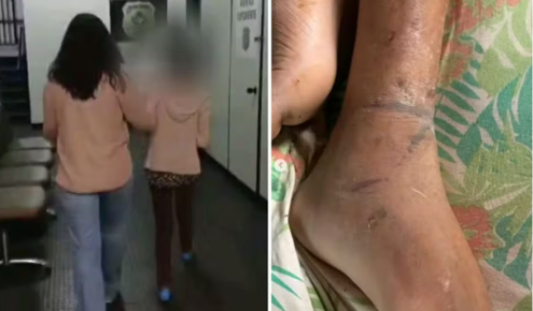 Homem acorrentado pela mãe em Goiás sofreu três AVCsv