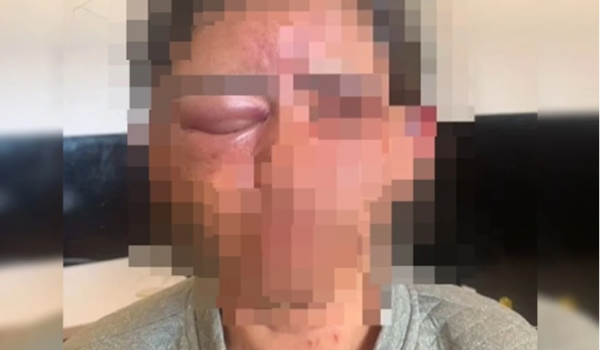 Mulher é estrangulada com toalha após invasão de casa em Cristalina