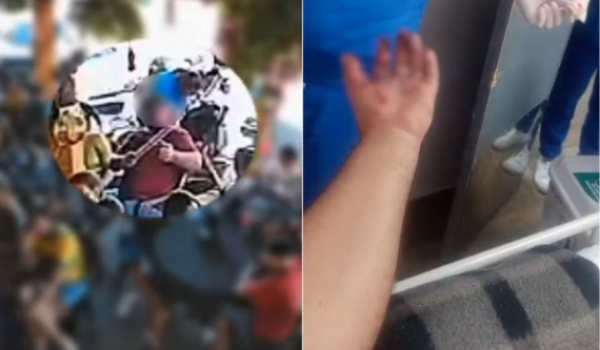 Torcedor tem mão dilacerada após rojão explodir durante jogo do Brasil em Goiás