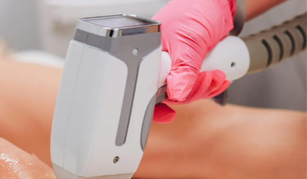 Mulher queimada em depilação a laser será indenizada
