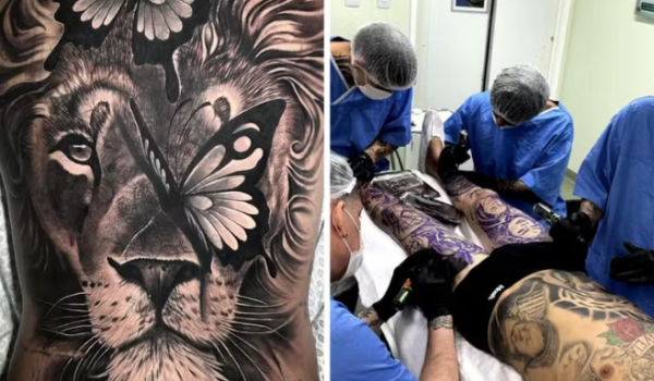 CFM proíbe uso de anestesia geral para tatuagens: entenda os riscos e exceções