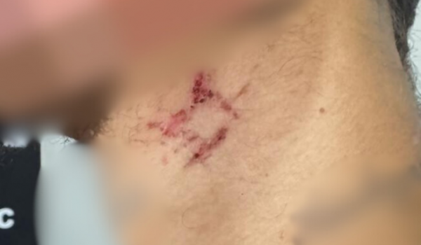 Homem é libertado após um ano mantido como escravo sexual por traficante em Goiânia