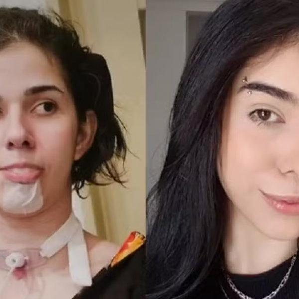 Mãe de jovem que ficou com sequelas após cheirar pimenta faz desabafo após três anos do caso